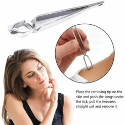 DIYOZZY Outil Pour Enlever Les Tiques Des Animaux Domestiques Crochet à Tiques En Acier Inoxydable Outil Professionnel Pour Chat Chien Cheval Humain -Toilletage et hygiène du chien Soldes 34215769 3