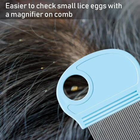 BEARSU Peigne à Cheveux Pour Enlever Les Lentes De 6 Pièces Avec Loupe, Outil De Dents En Métal Fin Pour Chiens, Chats, Toilettage Et élimination Des Flocons De Pellicules/œufs De Poux (bleu Ciel) 3 BEARSU Peigne à Cheveux Pour Enlever Les Lentes De 6 Pièces Avec Loupe, Outil De Dents En Métal Fin Pour Chiens, Chats, Toilettage Et élimination Des Flocons De Pellicules/œufs De Poux (bleu Ciel) – Image 3