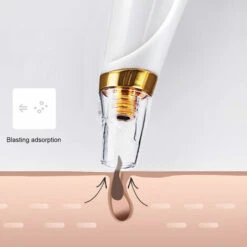 ASUPERMALL Extracteur De Boutons Sous Vide Pour Points Noirs Avec Kit D'Aiguilles Pour Points Noirs Incurves Kit D'Elimination De L'Acne, Blanc -Toilletage et hygiène du chien Soldes 36706270 5