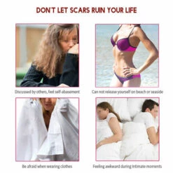 ASUPERMALL Lanbena Creme D'Elimination Des Cicatrices D'Acne Creme Pour Le Visage Reparation De La Peau Traitement Localise De L'Acne 30G -Toilletage et hygiène du chien Soldes 39616376 3