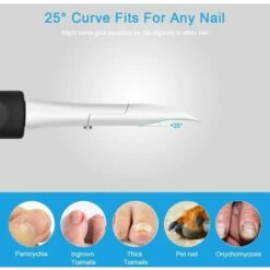 ALMI Pince à Ongles. Coupe-Ongles De Précision Pour Épais Orteils Fungus. Pince Ongle Incarné. Pince Ongle Professionnel En Acier Inoxydable -Toilletage et hygiène du chien Soldes 50909930 5