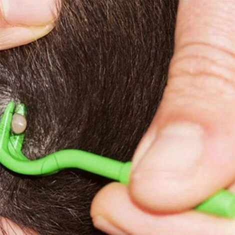 LITZEE Kit D'outils De Suppression De Tiques Pour Chien Chat Dissolvant De Puces Humaines Dissolvant De Tiques Avec 3 Crochet De Tique Pour Chiens Chats Chevaux Animaux De Compagnie Humain,Vert 4 LITZEE Kit D'outils De Suppression De Tiques Pour Chien Chat Dissolvant De Puces Humaines Dissolvant De Tiques Avec 3 Crochet De Tique Pour Chiens Chats Chevaux Animaux De Compagnie Humain,Vert – Image 4