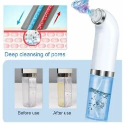 DECKON Aspirateur Electrique Pour Points Noirs, Instrument De Beaute Par Aspiration Pour Eliminer L'Acne Et Kit D'Aiguilles Pour Le Traitement De L'Acne -Toilletage et hygiène du chien Soldes 52978277 4